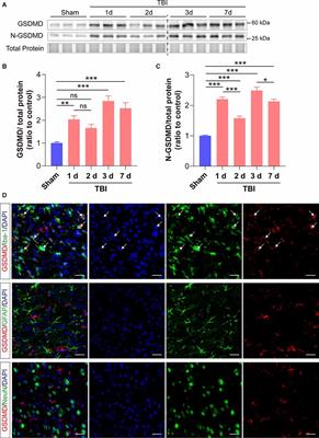 Ablation of GSDMD Attenuates Neurological Deficits and Neuropathological Alterations After Traumatic Brain Injury
